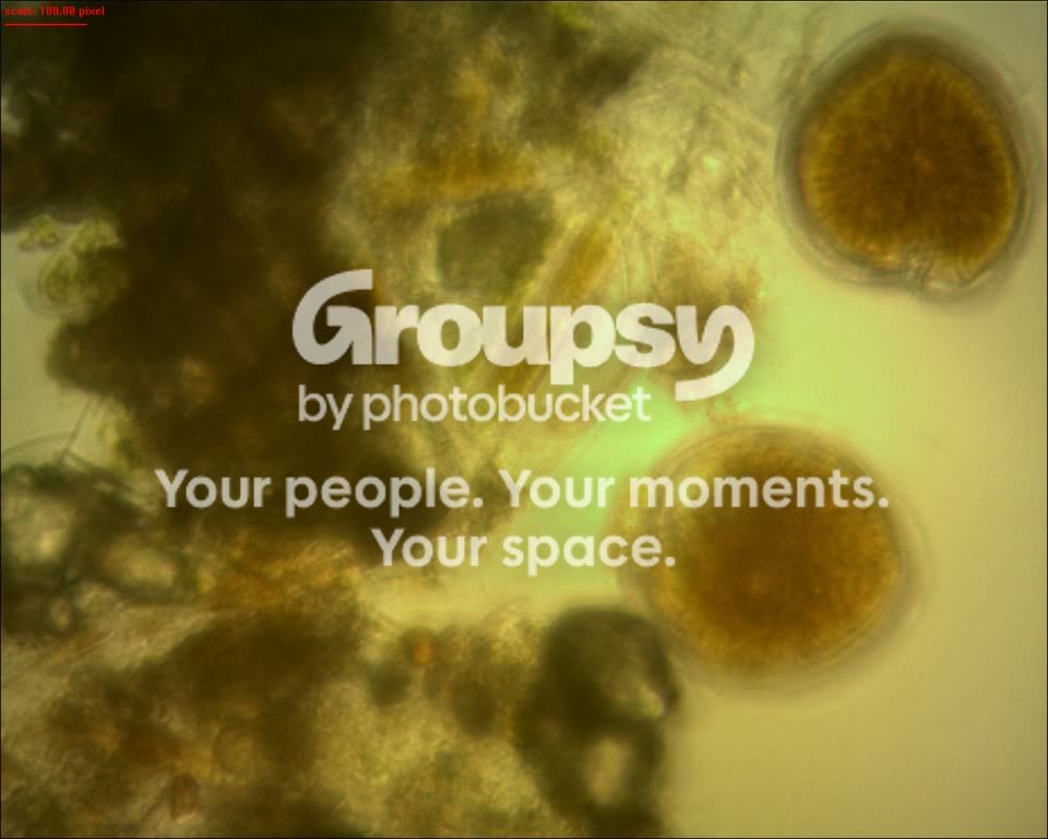 [TodoMarino.com] Algas al microscopio ,que son??